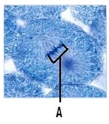 What phase of mitosis is pictured?   A)  prophase B)  prometaphase C)  metaphase D)  anaphase E)  telophase 