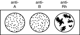 What blood type does an individual have according to the blood typing results illustrated in this figure?   A)  O positive B)  A negative C)  B positive D)  AB negative E)  O negative
