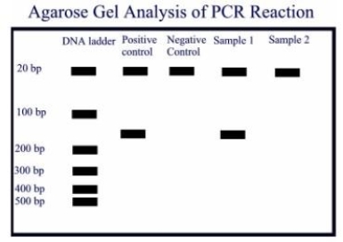  -A PCR amplification was done on a positive control containing the template DNA, a negative control without the template DNA and two samples. Oligonucleotide primers of 21 base pairs were used, and the expected amplicon product is about 160 base pairs. Observe the agarose gel electrophoresis done on the amplicons, and give the most appropriate interpretations.   A) The assay must be repeated because the positive control has more than one amplicon. B) The assay must be repeated because the amplicon is not the right size. C) The assay must be repeated because there is evidence of  primer dimer  formation. D) Sample 1 is positive for the template DNA, and sample 2 is negative for the template DNA. E) The assay must be repeated because the negative control is not negative.