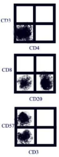 A transplant recipient showed signs of rejection, so she was treated with monoclonal anti- CD3 (OKT3) . Flow cytometry was done on her blood after treatment with results as shown in the figure. The gate was set on lymphocytes. What is the best interpretation of that analysis given?   A) The treatment is working adequately. B) The treatment is not working adequately. C) The fluorescent compensation was not set correctly. D) The lymphocyte gate was not set correctly.