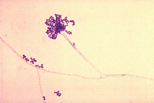 Identify the following:   A)  Rhizopus spp. B)  Mucor spp. C)  Histoplasma capsulatum D)  Aspergillus spp.