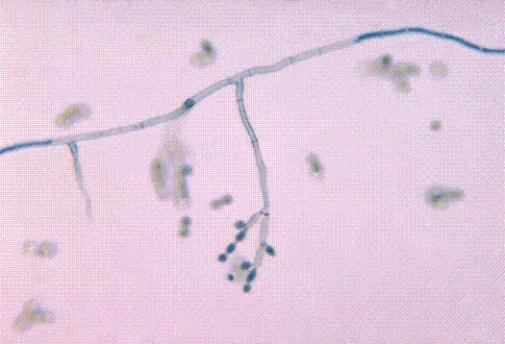 Identify the following:   A)  Cladosporium spp. B)  Candida spp. C)  Coccidioides immitis D)  Cryptococcus neoformans