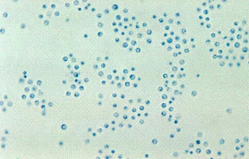 Identify the following:   A)  Coccidioides immitis B)  Blastomyces dermatitidis C)  Cryptococcus neoformans D)  Candida albicans