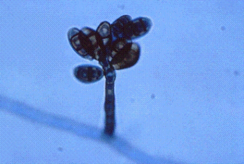 Identify the following:   A)  Mucor spp. B)  Rhizopus spp. C)  Alternaria spp. D)  Curvularia spp.