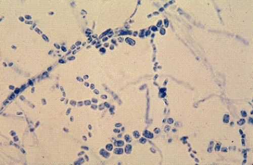 Identify the following:   A)  Mucor spp. B)  Penicillium spp. C)  Geotrichum spp. D)  Alternaria spp.