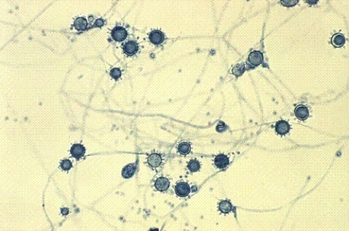 Identify the following:   A)  Histoplasma capsulatum B)  Toxoplasma gondii C)  Microsporum tonsurus D)  Paracoccidioides brasiliensis