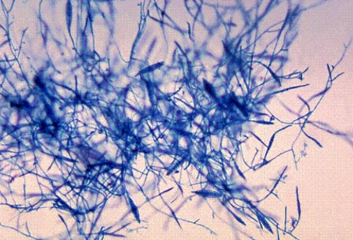 Identify the following:   A)  Trichophyton spp. B)  Mucor spp. C)  Microsporum canis D)  Blastomyces dermatitidis