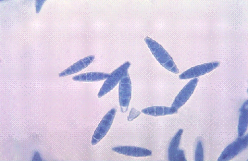 Identify the following:   A)  Trichophyton rubrum B)  Epidermophyton audouinii C)  Fonsecaea compacta D)  Microsporum gypseum