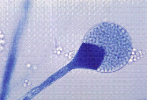 Identify the following:   A)  Mucor spp. B)  Microsporum spp. C)  Sporothrix schenckii D)  Malassezia furfur