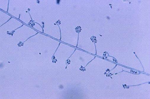 Identify the following:   A)  Trichosporon boydii B)  Sporothrix schenckii C)  Trichophyton rubrum D)  Microsporum canis