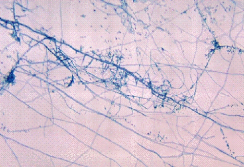 Identify the following:   A)  Microsporum canis B)  Sporothrix schenckii C)  Aspergillus fumigatus D)  Trichophyton mentagrophytes