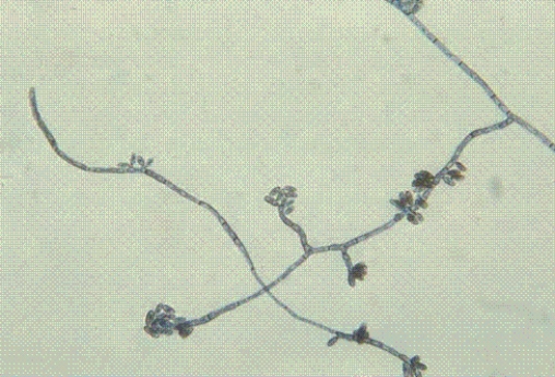 Identify the following:   A)  Malassezia furfur B)  Mucor spp. C)  Phaeoannellomyces werneckii D)  Microsporum canis