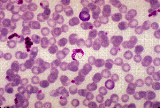 Identify the following:   A)  Leishmania donovani B)  Babesia microti C)  Plasmodium falciparum D)  Trypanosoma cruzi