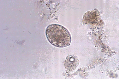 Identify the following:   A)  Hymenolepis nana B)  Taenia saginata C)  Diphyllobothrium latum D)  Taenia solium