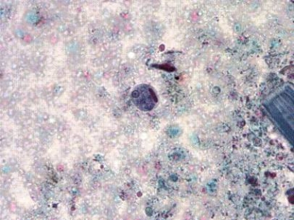 Identify the following:   A)  Entamoeba histolytica/E. dispar B)  E. hartmanni C)  Giardia lamblia D)  E. coli