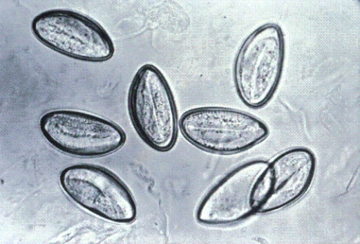 Identify the following:   A)  Trichuris trichiura B)  Enterobius vermicularis C)  Ascaris lumbricoides D)  Hookworm