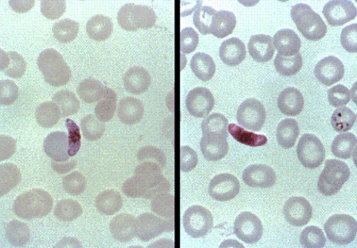 Identify the following:   A)  Plasmodium ovale B)  P. malariae C)  P. falciparum D)  P. vivax