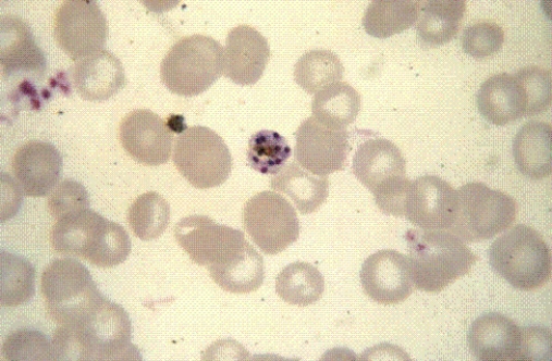 Identify the following:   A)  Plasmodium ovale B)  P. vivax C)  P. falciparum D)  P. malariae