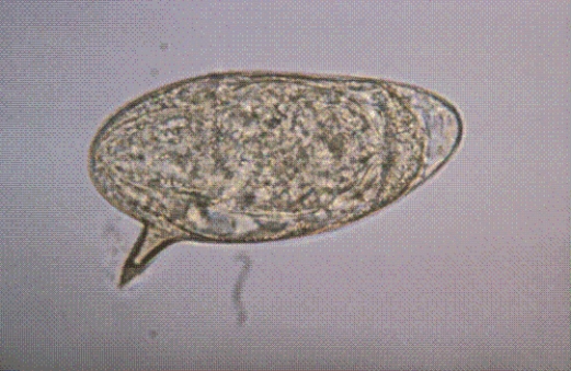 Identify the following:   A)  Schistosoma mansoni B)  S. japonicum C)  S. haematobium D)  S. madurella