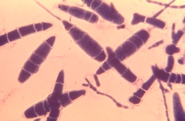 The following organism is isolated from a case of tinea capitis.The organism grew rapidly producing tan mold colonies.This organism is most likely:   A) Trichophyton rubrum. B) Epidermophyton audouinii. C) Fonsecaea compacta. D) Microsporum gypseum.