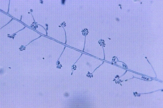A student working for the summer at a plant nursery has a nodular lesion on his forearm that develops a draining tract.The following organism is isolated from the culture at 22C.Identify the organism shown below.   A) Trichosporon boydii B) Sporothrix schenckii C) Trichophyton rubrum D) Microsporum canis