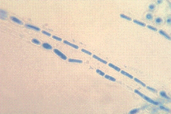 After returning from a vacation trip to the Amazon River delta in Brazil, a man notices a white dirtlike substance on his axilla hair that does not wash off in the shower.His health care provider samples the hairs and sends them to the laboratory for culture.Straw-colored yeastlike colonies show the following microscopic morphology.This is most consistent with an identification of:   A) Malassezia furfur. B) Trichosporon spp. C) Microsporum audouinii. D) Trichophyton rubrum.