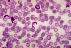 A young man from rural Brazil is visiting family in the United States when he becomes ill with muscle pains, high fever, and hepatosplenomegaly.A blood sample taken in the emergency room reveals the following organism.The most likely identification of this organism is:   A) Leishmania donovani. B) Babesia microti. C) Plasmodium falciparum. D) Trypanosoma cruzi.