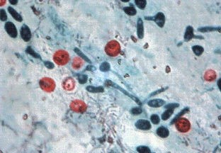 Five members of a family develop a sudden onset of watery diarrhea, nausea, vomiting, headache, and cramps.They go to the family physician who orders fecal cultures and complete ova and parasites (O&P)  analysis.Each sample reveals the presence of organisms seen below.The most likely cause of the infection is:   A) Cryptosporidium parvum. B) Isospora belli. C) Cyclospora cayetanensis. D) Encephalitozoon intestinalis.