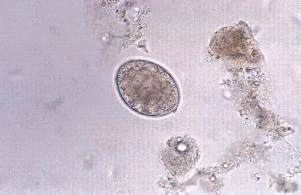 A housewife from the Great Lakes area comes to her family physician with fatigue and malaise.Blood tests show that she has enlarged but pale red blood cells (RBCs)  (megaloblastic anemia)  along with a vitamin B₁₂ deficiency.Her history includes a dietary habit of making pickled fish, a family favorite.Because of this, an O&P is also requested and reveals the following parasite egg.What is the identity of this parasite?   A) Hymenolepis nana B) Taenia saginata C) Diphyllobothrium latum D) Taenia solium