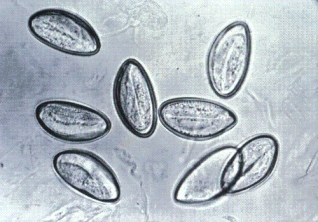 Several children at a daycare center are having trouble sleeping and are showing increasing signs of restlessness.Because one child was recently diagnosed with a parasite, the parents are informed that other children should be tested.The organism below is found during examination.This organism is:   A) Trichuris trichiura. B) Enterobius vermicularis. C) Ascaris lumbricoides. D) hookworm.
