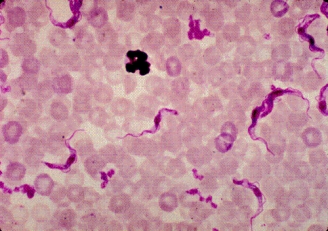 A young man who returned a week ago from a family vacation to Kenya, develops a high fever and delirium.Although he was compliant with his antimalarial medications, a blood sample is taken to rule out malaria.The laboratory scientist sees the following on the blood smear.This organism is most likely:   A) Trypanosoma brucei. B) Leishmania donovani. C) Wuchereria bancrofti. D) Loa loa.