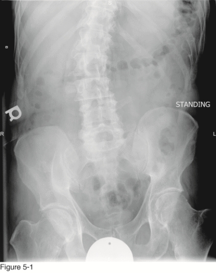   -According to Chapter 5, how should the findings section of the radiology report for this patient be formatted? A)  Bulleted B)  Number list C)  Grammatically correct paragraphs D)  Fragmented statements