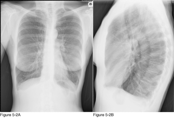   -Which section of the ABCS (alignment, bone, cartilage, soft tissue)  should be addressed first in the radiology report for the radiographs in Figure 5-2? A)  Alignment B)  Bone C)  Cartilage D)  Soft tissue