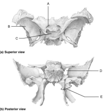   Figure 7.2 Using Figure 7.2, match the following: -Allow cranial nerves that control eye movements to enter the orbit.