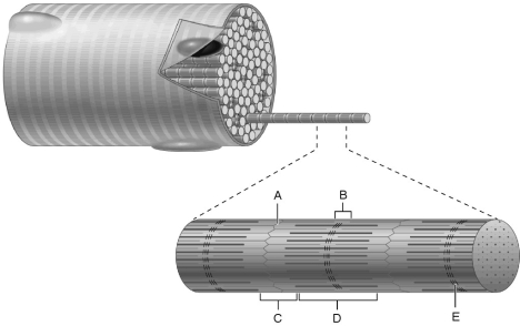    Figure 9.2 Using Figure 9.2, match the following: -I band.