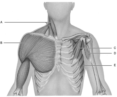    Figure 10.2 Using Figure 10.2, match the following: -Pectoralis minor.