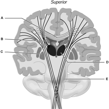    Figure 12.2 Using Figure 12.2, match the following: -Pons.