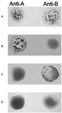    Figure 16.2 Using Figure 16.2, match the following: -Universal donor.