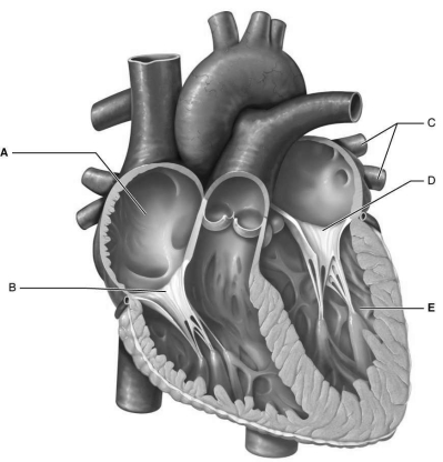    Figure 17.4 Using Figure 17.4, match the following: -Right atrium.