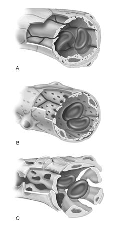    Figure 18.1 Using Figure 18.1, match the following: -Capillary that may contain Kupffer cells in the lining.