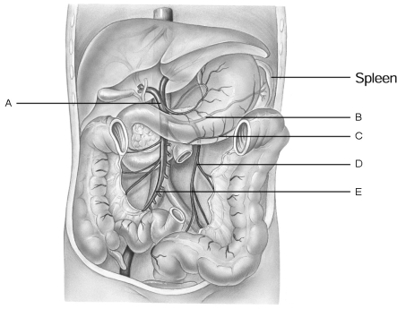    Figure 18.2 Using Figure 18.2, match the following: -Splenic vein.