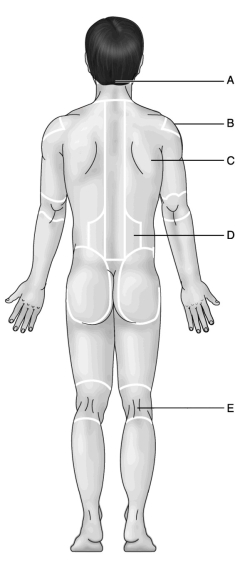Figure 1.2 Use the diagram above to answer the following questions.    -Which letter indicates the scapular region? A)  A B)  B C)  C D)  D E)  E