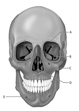    Figure 7.1 Use the diagram above to answer the following questions. -Which letter indicates the facial bone that has as inferior orbital fissure? A)  A B)  B C)  C D)  D E)  E
