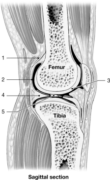  Figure 8- 2 A Simplified Sectional View of the Knee Joint Use Figure 8- 2 to answer the following questions: -The joints that connect the four fingers with the metacarpal bones are A)  hinge joints. B)  pivot joints. C)  ellipsoid joints. D)  condyloid joints. E)  saddle joints.