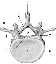 <strong>  Figure 7- 2 Typical Vertebra inferior view) Use Figure 7- 2 to answer the following questions: Identify the structure labeled 1.</strong> A) spinous process B) transverse articular facet C) pedicle D) lamina E) transverse process <div style=padding-top: 35px> 