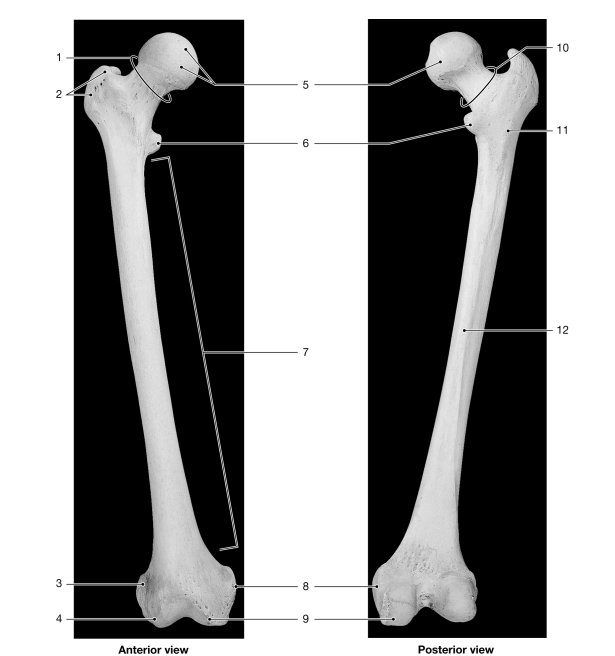   Figure 7- 6 The Femur Use Figure 7- 6 to answer the following questions: -The hypophyseal fossa of the sella turcica contains the _______gland. A)  nasal B)  pituitary C)  lacrimal D)  sellar E)  olfactory