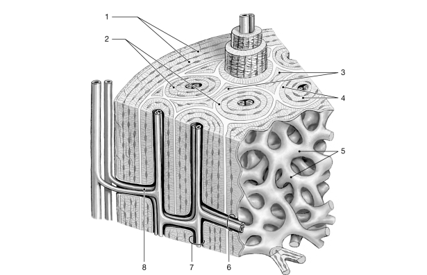   Figure 6- 1 Bone Tissue Use Figure 6- 1 to answer the following questions) : -The structure labeled  3  is the result of which process? A)  remodeling of compact bone B)  osteoporosis C)  bone cells adding matrix between existing osteons D)  surface growth of bone E)  remodeling of spongy bone