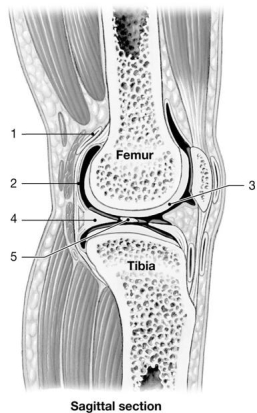   Figure 8-1 -Which structure acts as a cushion and consists of fibrocartilage? A) 1 B) 2 C) 3 D) 4 E) 5