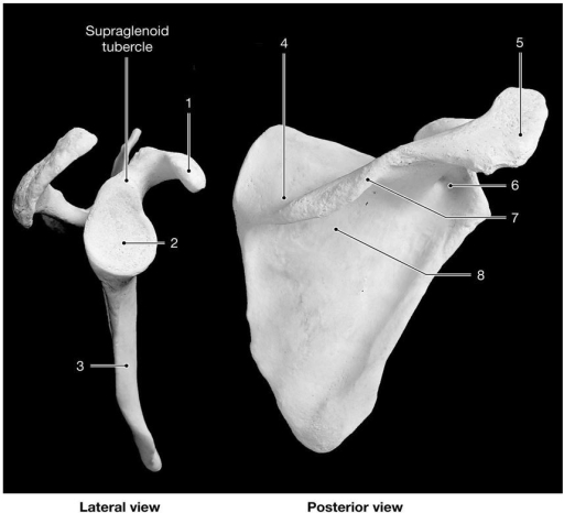   Figure 7-3 -Identify the structure labeled  2.  A) glenoid cavity B) acetabulum C) scapular cavity D) scapular notch E) rotator cup