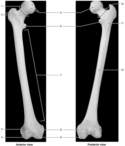   Figure 7-5 -Identify the structure labeled  12.  A) greater trochanter B) linea aspera C) head D) lateral epicondyle E) lateral condyle